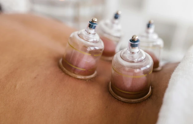 CAP Gistel - massage - cupping